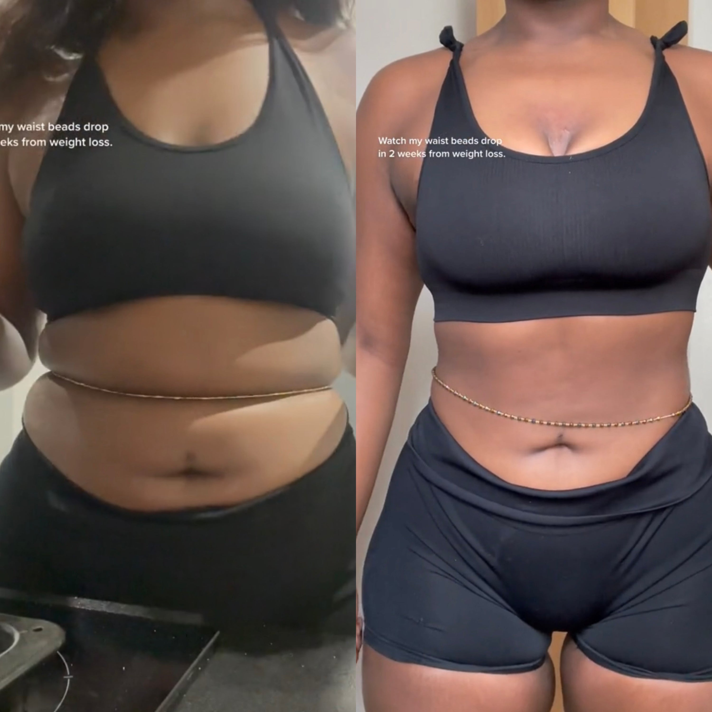 Belly Bloated? Here’s What It’s Really Trying to Tell You
